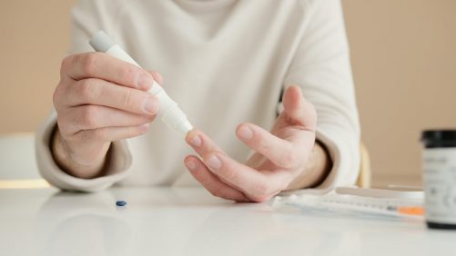 Ee. Uu. Aprueba Uso Inédito de Test Sanguíneo para Alzheimer Creado por multinacional japonesa | Internacional | Noticias