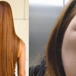 se le inflamó el cráneo y su cara