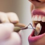 Los grillz, la tendencia viral de TikTok que los dentistas recomiendan no seguir | Internacional | Noticias